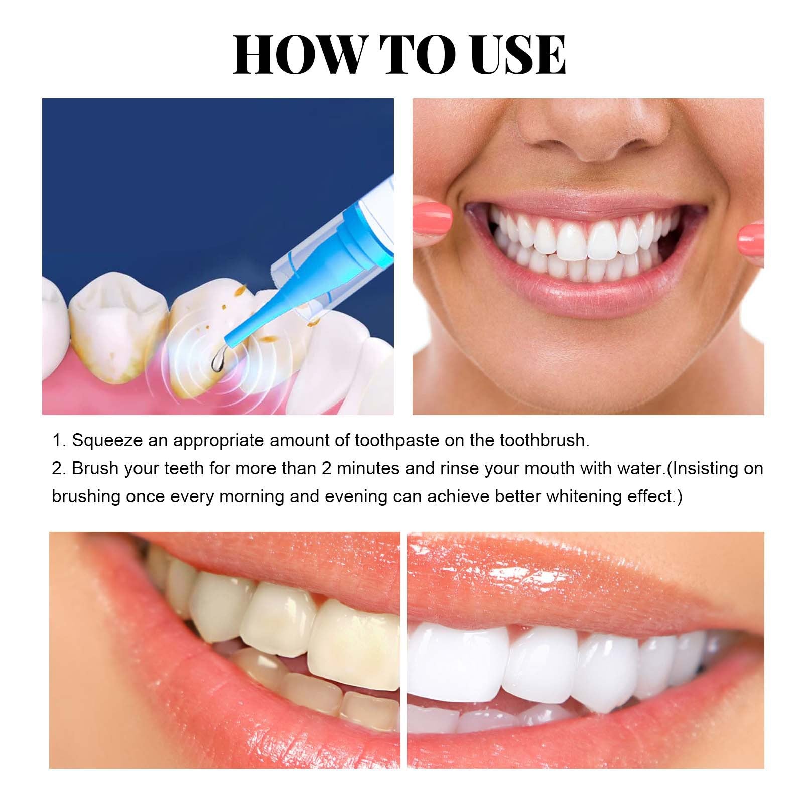 Dental Stain Removing Gel For Gum Repair